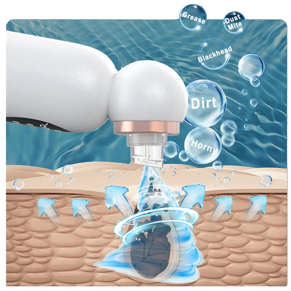 HydraVac™ – Aspirateur de Points Noirs à Bulles & Soin Hydratant Réparateur