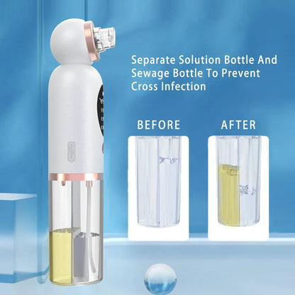 HydraVac™ – Aspirateur de Points Noirs à Bulles & Soin Hydratant Réparateur