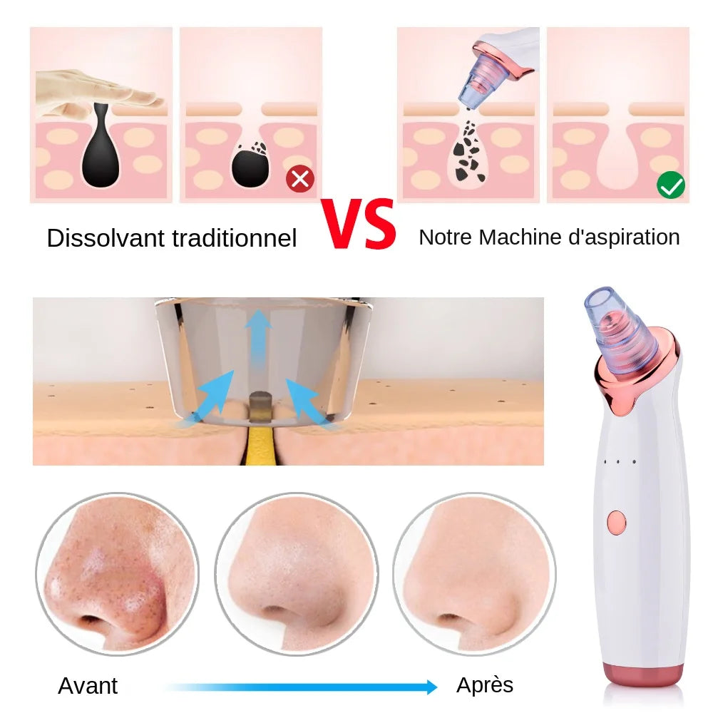 PoreLift™ – Nettoyeur Visage à Aspiration Ciblée