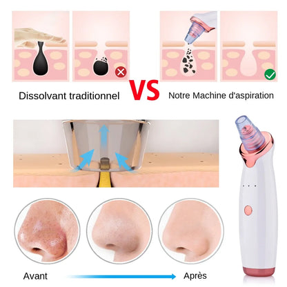 PoreLift™ – Nettoyeur Visage à Aspiration Ciblée