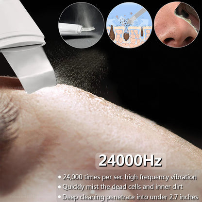 SkinWave | Spatule Ultrasonique Nettoyante & Lifting Visage 4-en-1