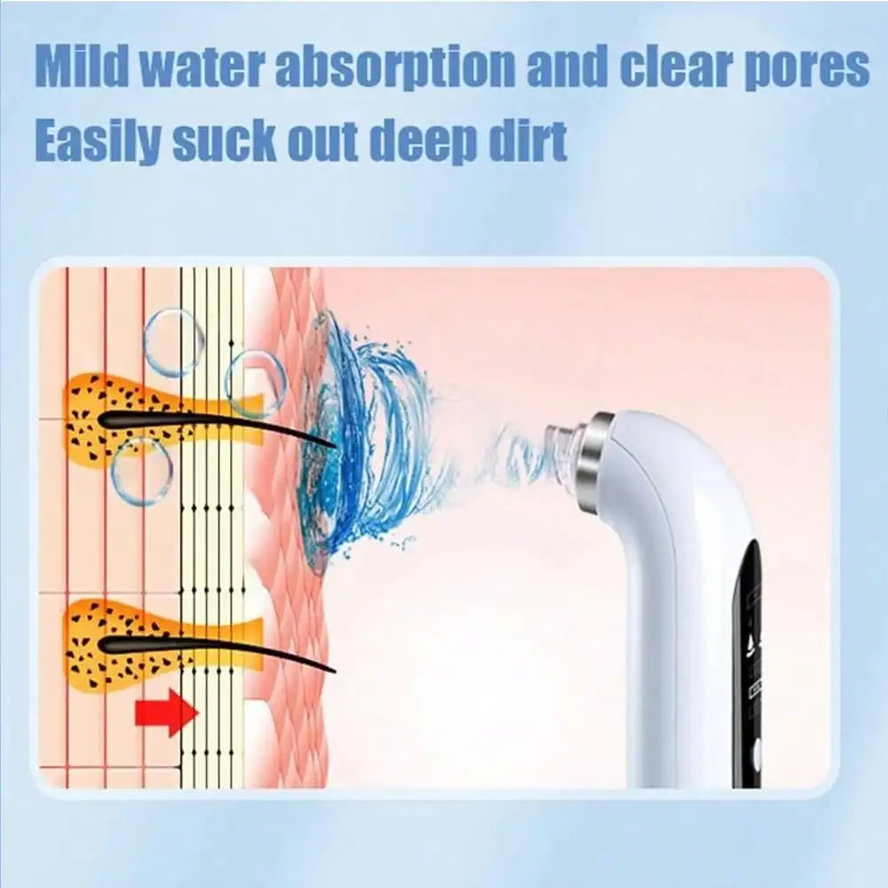 AEROSKIN™ – Extraction Douce & Contrôle du Sébum